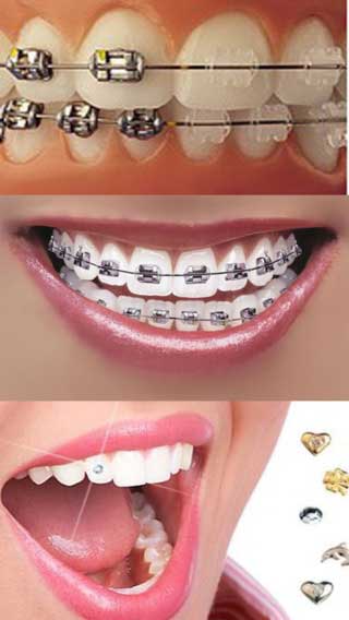 تطبيق Orthodontic تقويم الاسنان: نصائح وإرشادات