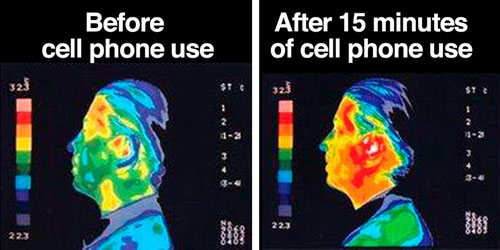 تأثير الموجات الكهرومغناطيسية على درجة حرارة الرأس - الصورة على اليمين تؤكد زيادة الحرارة بعد 15 دقيقة استخدام للهاتف